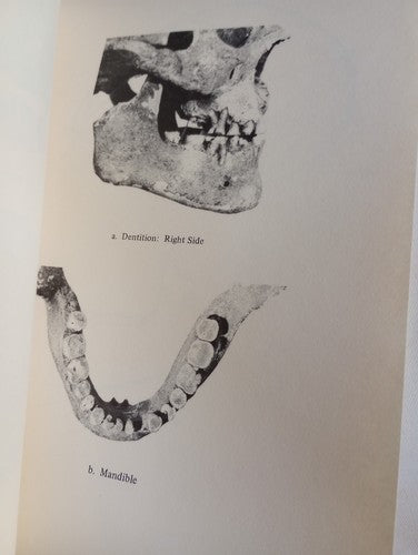 An Ancient Human Skeleton Found At Del Mar California By Spencer Rogers San Dieg