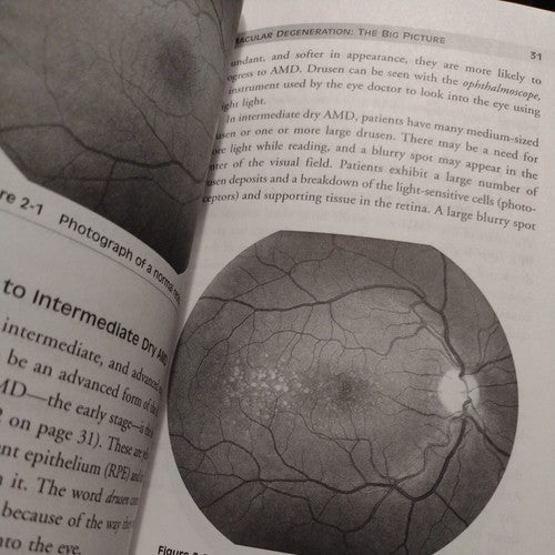 Macular Degeneration : A Complete Guide for Patients and Their Families by Mich
